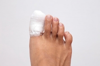 Handle With Care: What to Do if You Break Your Toe
