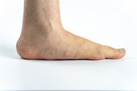 Is Having Flat Feet Bad?